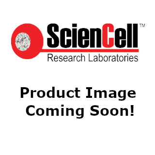 GeneQuery™ Human Complications of Diabetes qPCR Array (GQH-DBC) Catalog # GK052 | ScienCell Research Laboratories
