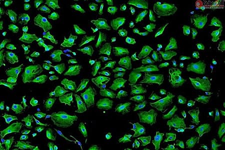 epithelialblog